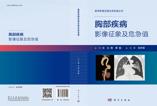 胸部疾病影像征像及危急值 商品图3