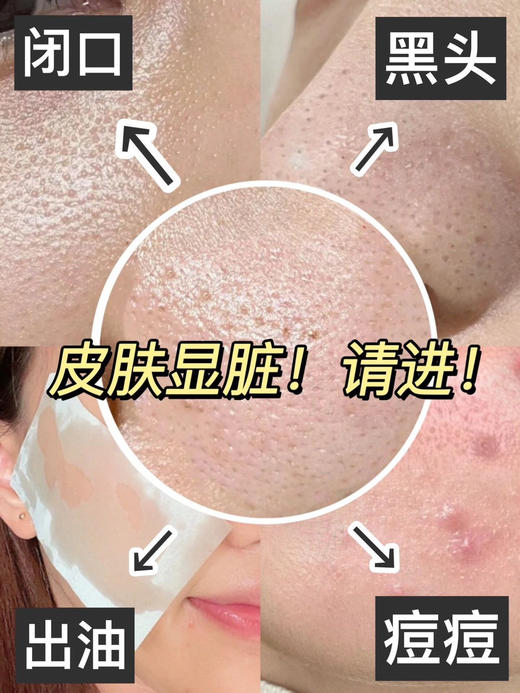 润熙泉清洁泥膜浅釉净澈泥膜110g/瓶 商品图8