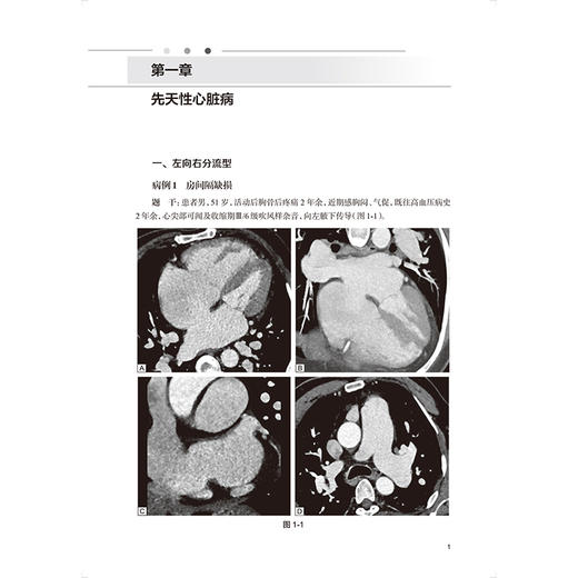心脏大血管疾病放射影像诊断思维与决策 张龙江 王怡宁 住院医师规范化培训结业临床实践能力考核标准方案解读丛书 人民卫生出版社 商品图4