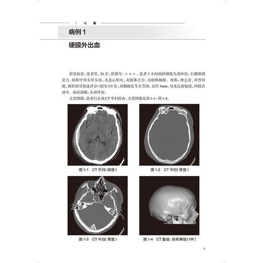 放射影像诊断报告书写 杨正汉 宋彬 住院医师规范化培训结业临床实践能力考核标准方案解读丛书 供放射影像专业用 人民卫生出版社 商品图4