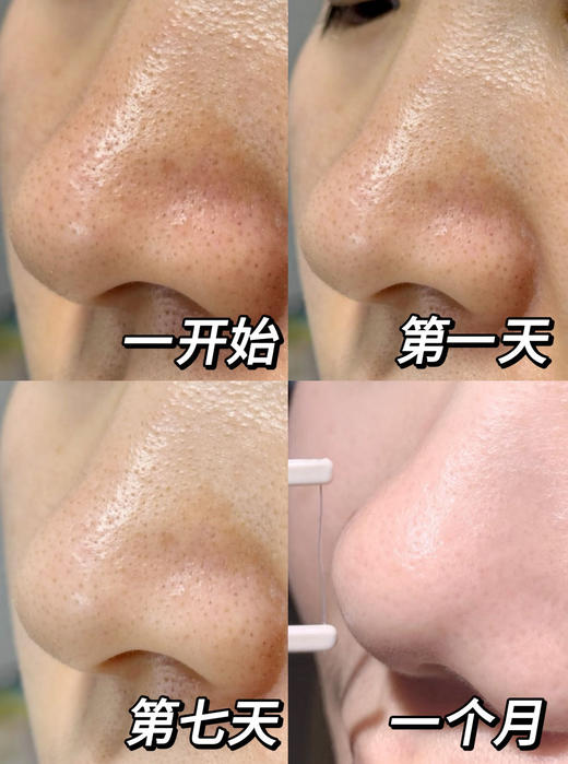 润熙泉清洁泥膜浅釉净澈泥膜110g/瓶 商品图5