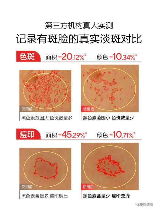 【重磅新品】欧诗漫超能淡斑水乳美白淡斑不反黑淡化暗沉去黄温和 商品图1