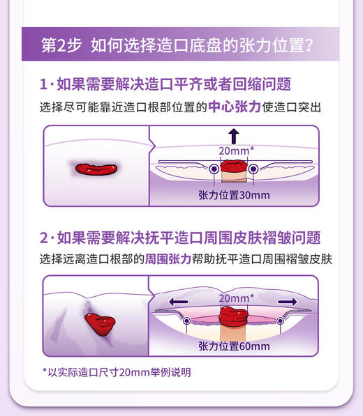 CONVATEC康维德Esteem Body爱顺宜一件式软凸开口大便造口袋423666 商品图5
