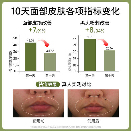 【植萃祛痘安肌乳】妈妈说 · 植萃祛痘安肌乳控油淡保湿化痘舒缓印敏感肌适用 商品图3