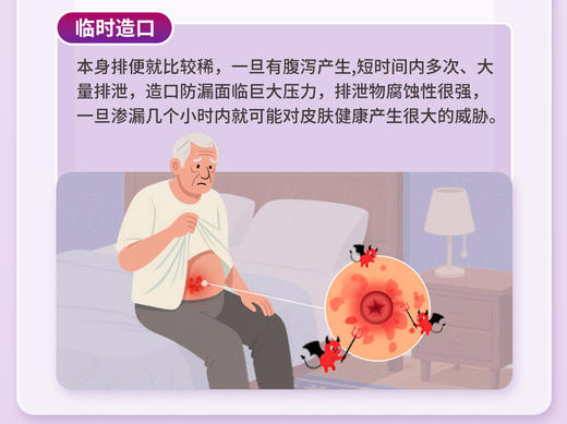 康维德舒洁两件式可塑平面造口袋底盘 免裁剪411800/411802/411804/411806 商品图7