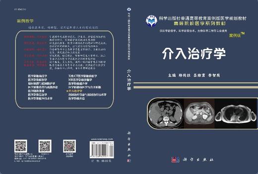 介入治疗学 商品图3