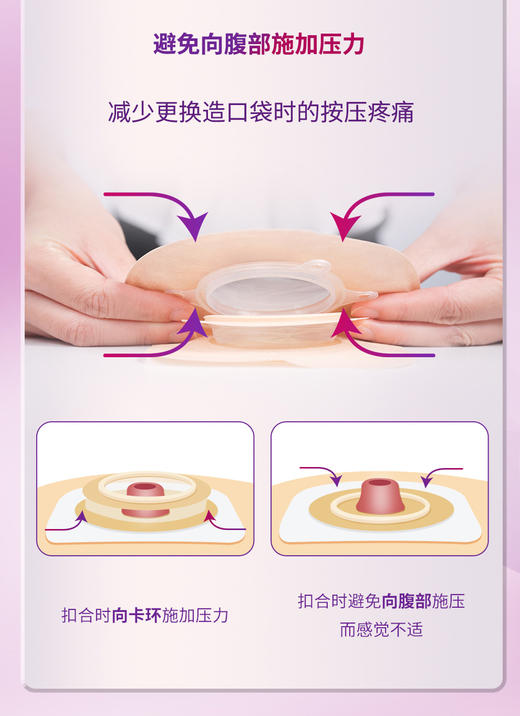 CONVATEC康维德两件式NATURA两件式耐用风琴可塑平面底盘421039/421040/421041 商品图8