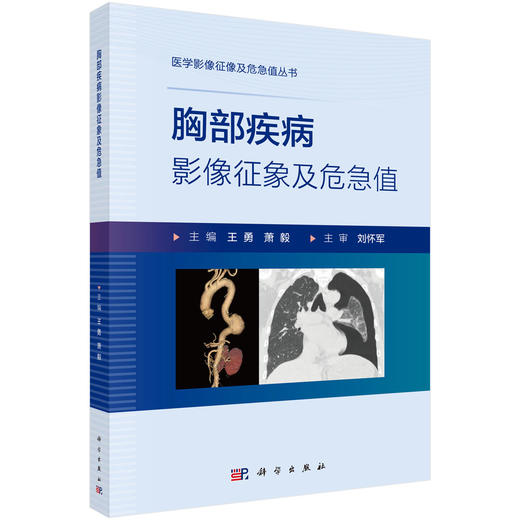 胸部疾病影像征象及危急值 医学影像征像及危急值丛书 王勇 萧毅 适用临床医师 放射医师 医学生 医学相关领域服务者等 科学出版社 商品图1
