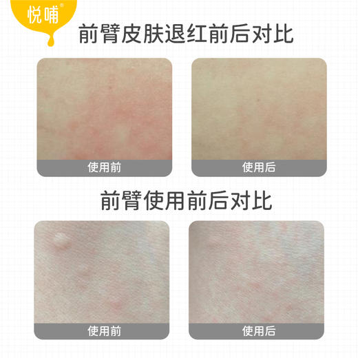 【新品热销】悦哺宝贝多效舒缓乳30g 商品图7