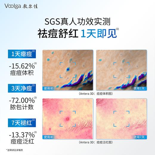 【新品上市】敷尔佳祛痘舒缓痘痘贴 商品图5