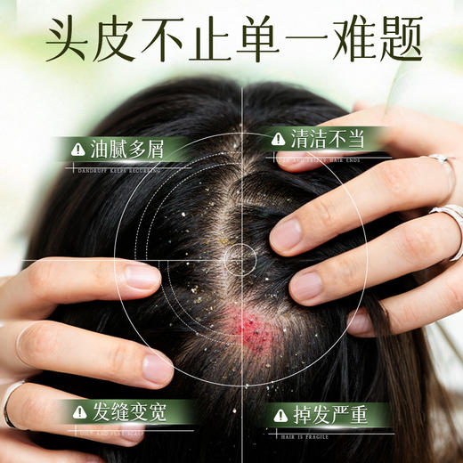 春节不打烊【植萃韧发❗️护发清洁】百力巨人草本植萃侧柏叶洗发水头发清洁控油蓬松控油洗发露。jd 商品图3