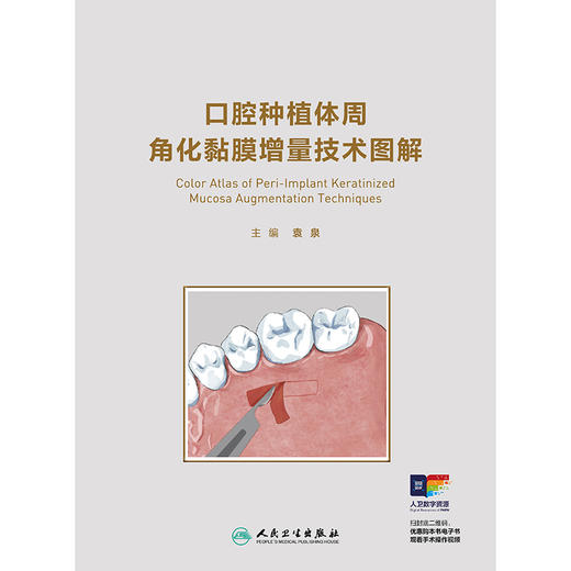 【预售】口腔种植体周角化黏膜增量技术图解 商品图1