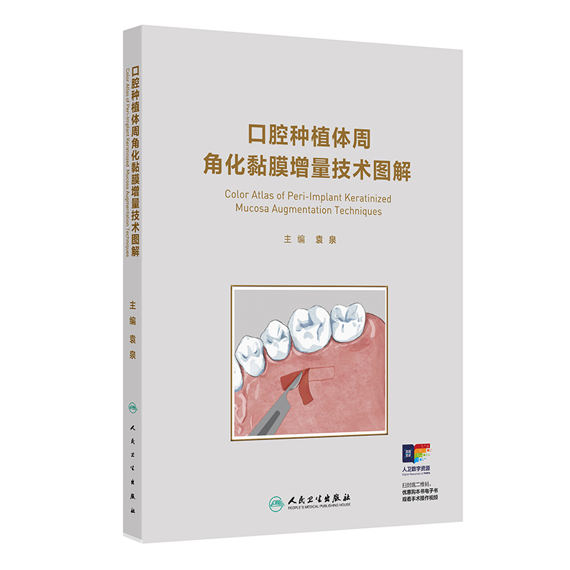口腔种植体周角化黏膜增量技术图解