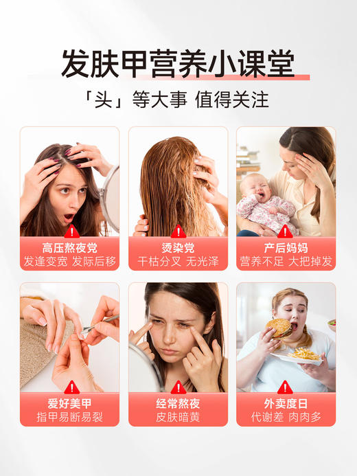 【养出蓬发 焕亮美肌🍓】Ameri-Vita多维夹心软糖10粒装/袋 复合维生素养发 软糖 女士多维 叶酸护掉头发 进口生物素（有效期2027-01-21） 商品图1