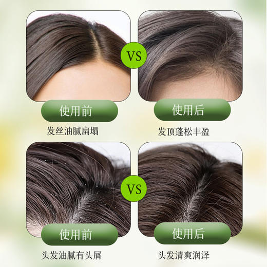 清仓【1件29元】卓蓝雅生姜头皮按摩膏25ml*6（8号果冻装） 商品图3