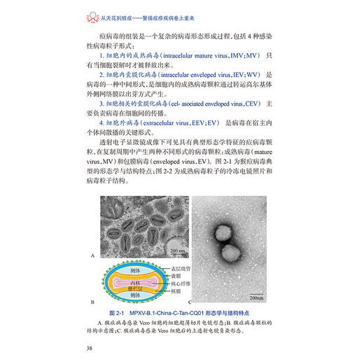 从天花到猴痘——警惕痘疹疾病卷土重来 杨永弘 马琳 主编 中医防治天花的实践历程 痘病毒感染性疾病的实验室诊断人民卫生出版社 商品图4