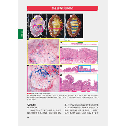 【出版社代发】《胃与肠》式图像解读病例集——内镜诊断思维基础与应用 代剑华 冯晓峰 陈瑶 周学谦 主译 辽宁科学技术出版社 商品图4