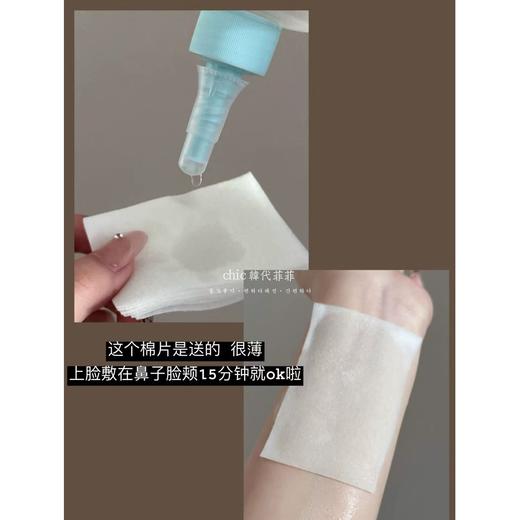 黑头拜拜~ 韩国ilso黑头水150ml+棉片40片黑头导出精华液黑头导出液 去黑头粉刺毛孔清洁控油修护一苏 商品图7