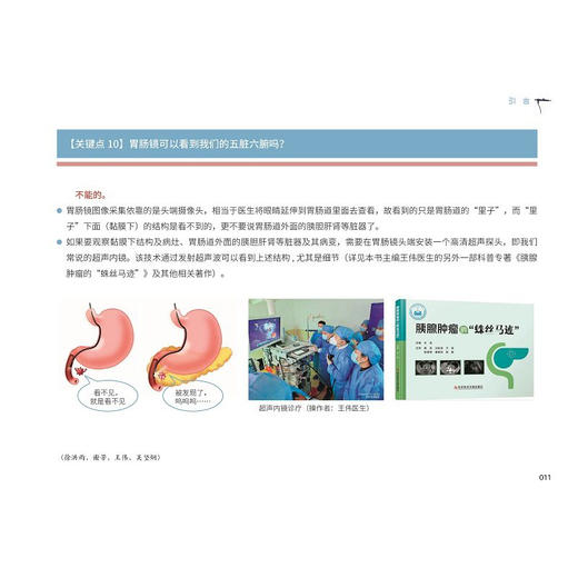 胃肠镜的“方寸之间”中国抗癌协会科普系列图书 王伟 王婷 谢芳 供消化科 胃肠及肝斟胰外科等相笑专业医师阅读科学技术文献出版社 商品图4
