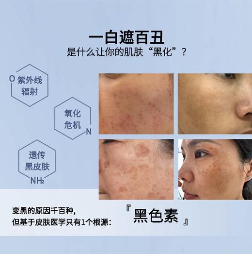 安极白月光美肤套小套 祛斑 商品图4