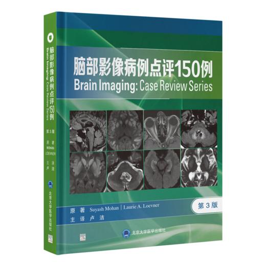 脑部影像病例点评150例 第3三版 卢洁 主译 涵盖了150例脑部影像案例 包括初、中、高级难度各50例等 北京大学医学出版社 商品图1