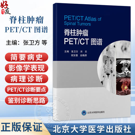 脊柱肿瘤 PETCT 图谱 张卫方 宋乐 祝安惠 赵梅莘 脊髓疾病 神经组织肿瘤 影像诊断 图谱 影像学9787565935190北京大学医学出版社 商品图0