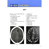 脑部影像病例点评150例 第3三版 卢洁 主译 涵盖了150例脑部影像案例 包括初、中、高级难度各50例等 北京大学医学出版社 商品缩略图4