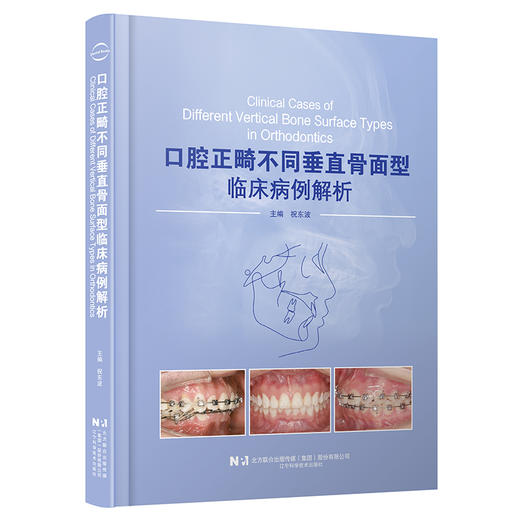 口腔正畸不同垂直骨面型临床病例解析 祝东波 主编 内容涵盖实用临床正畸固定矫治技术病例 9787559144454 辽宁科学技术出版社 商品图1