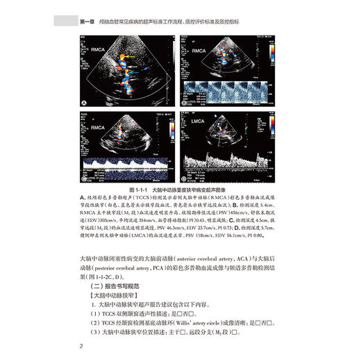 超声医学质量控制管理规范 血管分册 国家超声医学质量控制中心 北京市超声医学质量控制和改进中心 9787117383189 人卫出版社 商品图4