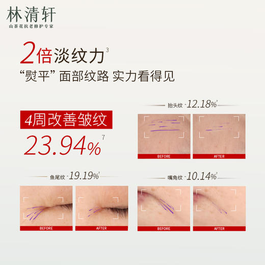 女神节专属！ 【拍1享30件】林清轩5.0精华油30ml+30ml+3ml*3+0.7ml+红山茶淡纹水99ml+泛醇面膜6片+次抛15支加赠礼盒配刮板~以油养肤，抗老 修护 保湿的高端精华油！ 商品图6