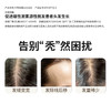 希格玛激光生发仪器适合脂溢性脱发雄性激素源性脱发160|200颗灯珠充电使用 商品缩略图2