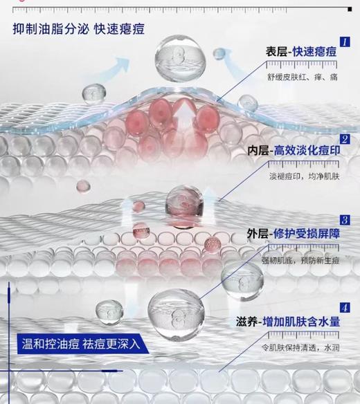 珍达菲 青少年净痘祛痘洁面泡沫+舒缓保湿乳（套装） 商品图3