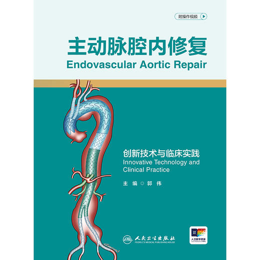 主动脉腔内修复——创新技术与临床实践 商品图1
