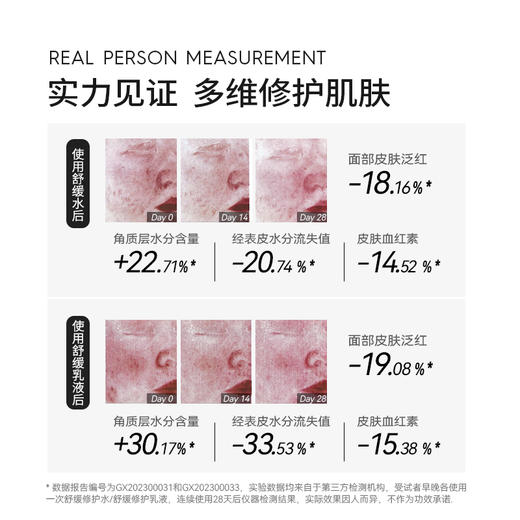 【水乳】德妃水乳套盒 内含：水200ml+乳液200ml+旅行套装（水20ml+乳20ml+7ml面霜+5ml精华） 商品图2