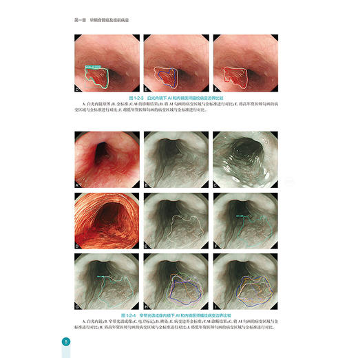 消化内镜人工智能及创新诊疗技术精解——食管篇 胡兵 叶连松 袁湘蕾 系统介绍食管疾病先进内镜微创诊疗技术的专著人民卫生出版社 商品图4