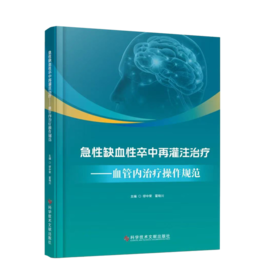 急性缺血性卒中再灌注治疗——血管内治疗操作规范