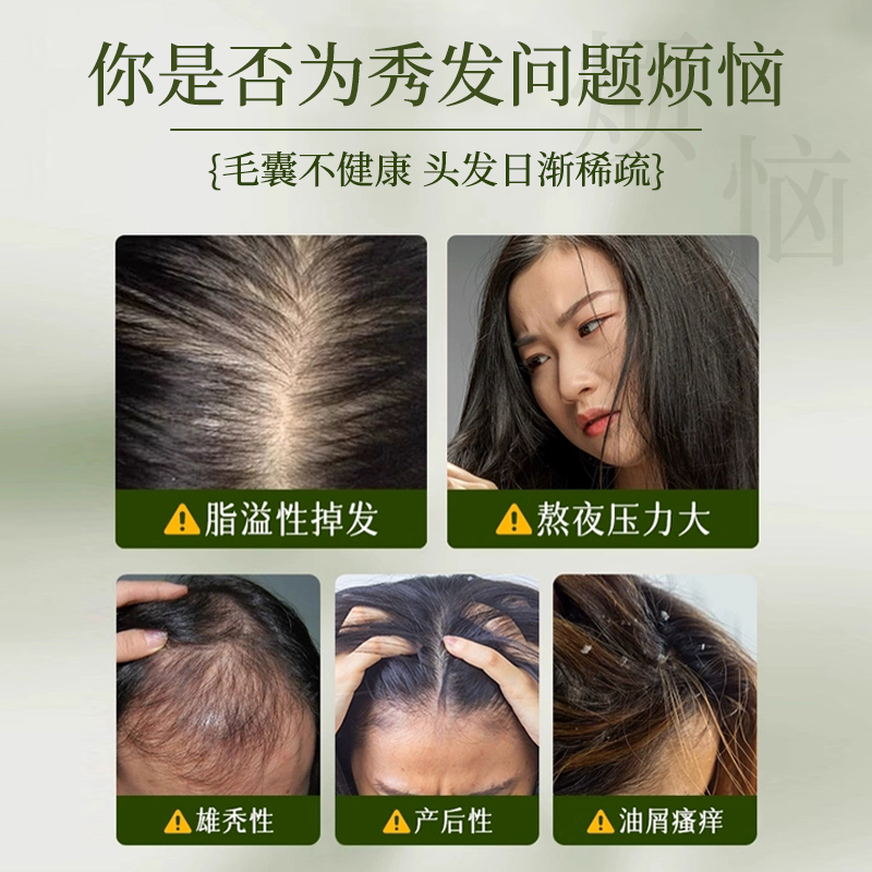 【乌斯曼侧柏叶植萃精研洗发皂】 植物本草 泡沫绵密 易冲易洗 温和不刺激