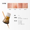 【控油系列-祛痘凝胶/祛痘精华液】毕生之研水杨酸祛痘凝胶15ml 点涂祛痘精华液10g 商品缩略图7