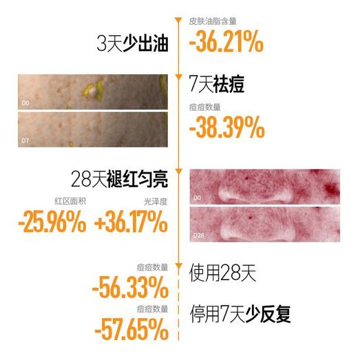 【控油系列-精华液】毕生之研3.0五环控油调理精华液air 15ml +1.5ml*2 商品图2