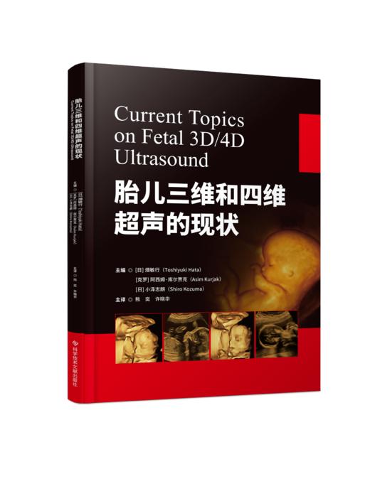 正版现货 胎儿三维和四维超声的现状 熊奕 许晓华主译 商品图0