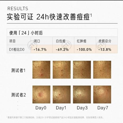 【控油系列-祛痘凝胶/祛痘精华液】毕生之研水杨酸祛痘凝胶15ml 点涂祛痘精华液10g 商品图2