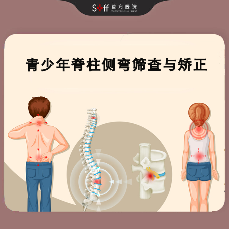 青少年脊柱侧弯筛查与矫正