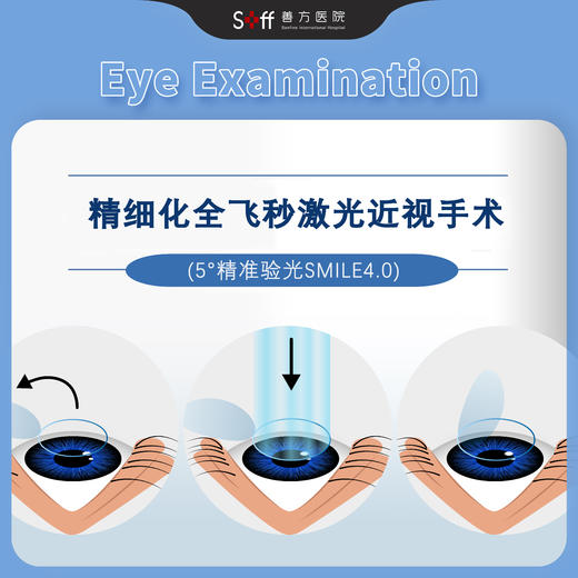 精细化全飞秒激光近视手术（SMILE） 商品图0