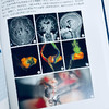 脑干肿瘤外科学 商品缩略图4