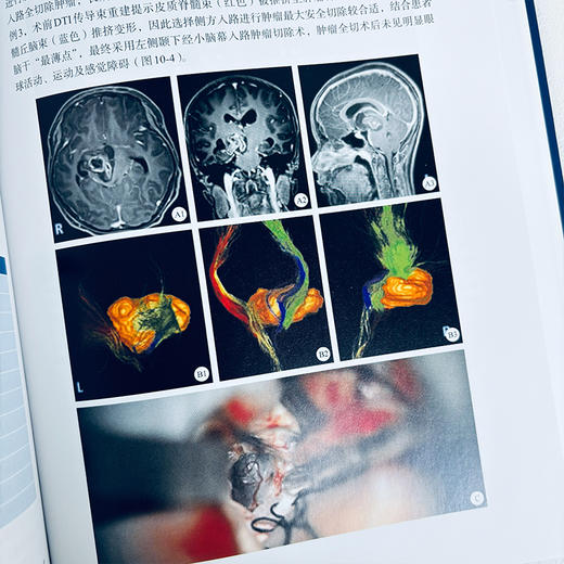 脑干肿瘤外科学 商品图4