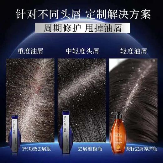 【强控屑】滋源1%二硫化硒去屑止痒无硅油蓝极光洗发水215g（热卖金榜） 商品图3