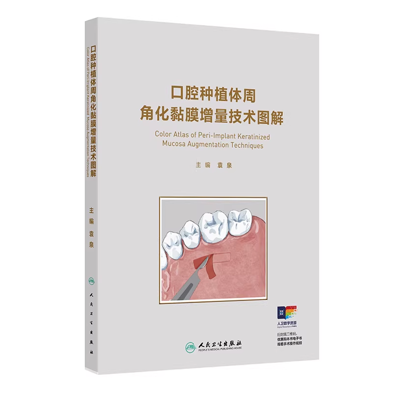 口腔种植体周角化黏膜增量技术图解（附手术视频）