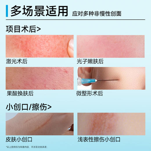 悦丝汀医用重组胶原蛋白修护敷料r乳50g术后创面保护乳液状非面膜（不参与店铺任何活动|包括满赠、新客抽奖、入会礼、回购礼、积分兑换等） 商品图1
