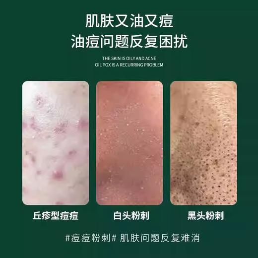 颜伊施壬二酸焕颜精华霜20g 商品图2