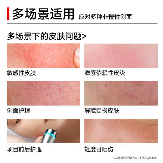 悦丝汀医用修复敷料喷剂神经酰胺敏感肌术后屏障损伤护理50ml（不参与店铺任何活动|包括满赠、新客抽奖、入会礼、回购礼、积分兑换等） 商品图2